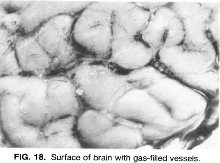 The brains of divers 1,2, and 3, were filled with gasses. The autopsy details that this gas resembles "butter on a frying pan."