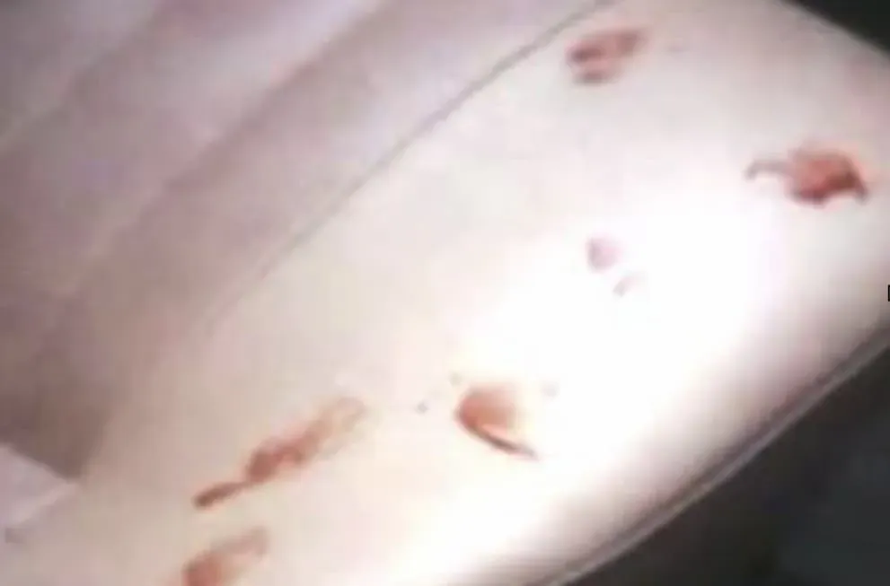 Police found blood stains in Michael Reimer's truck. Was this only Diana's blood? Was other test ran for additional DNA?