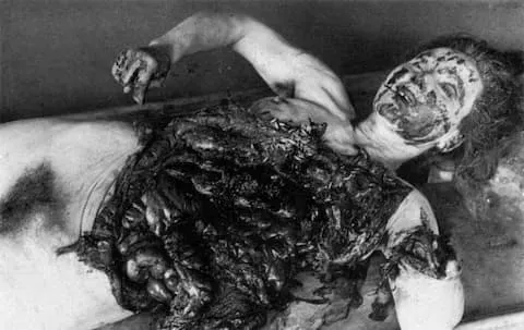 A maruta is flayed open after undergoing a vivisection by Unit 731 scientist.