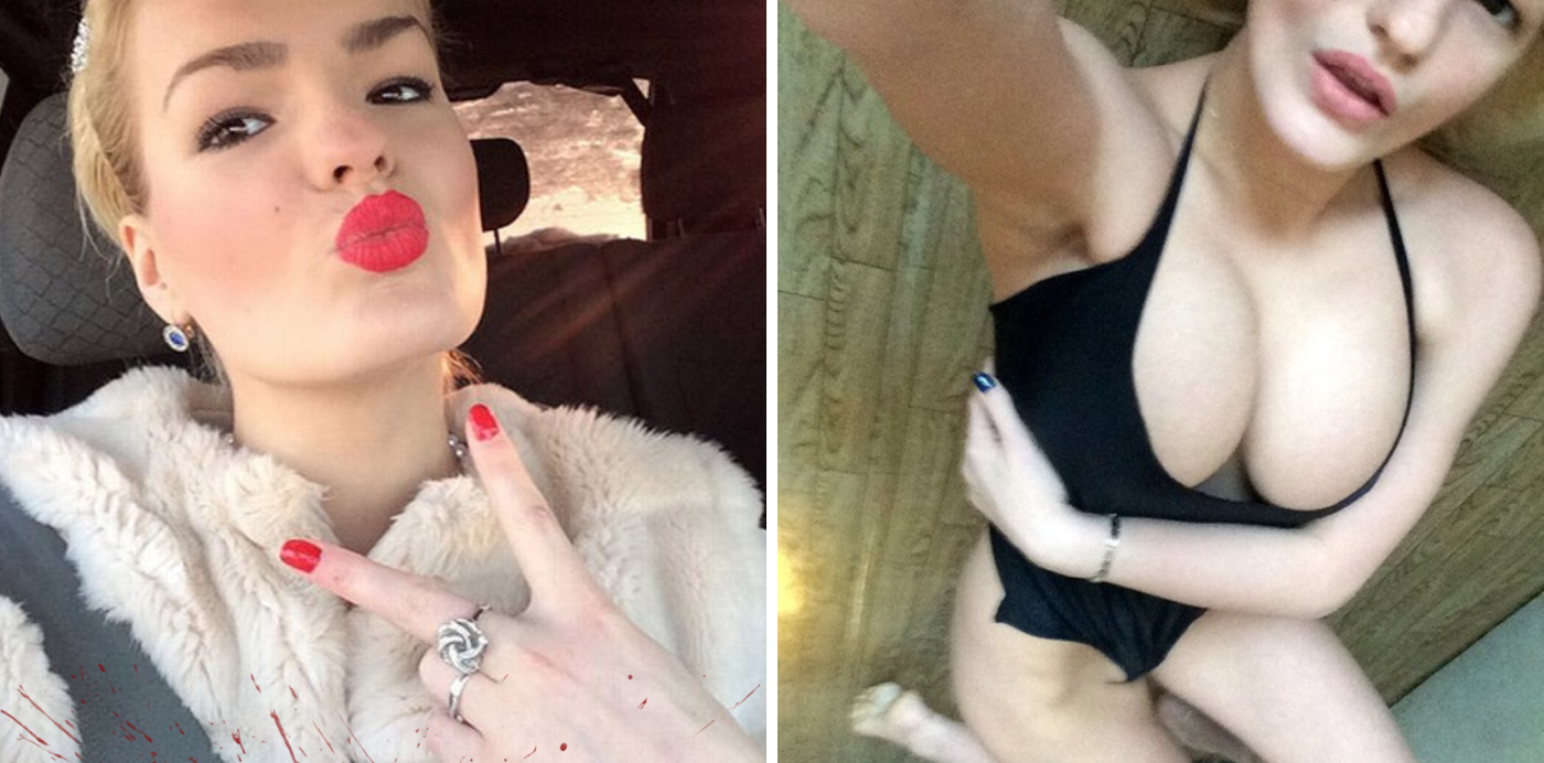 Beautiful Model’s Eyes GOUGED Out By Her Jealous Sister During “Drug-filled Rage Attack”